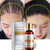 Hair Care Hair Growth Essential Oils Essence Authentic 100% Hair Loss Liquid Health Care Beauty Dense Serum Useful